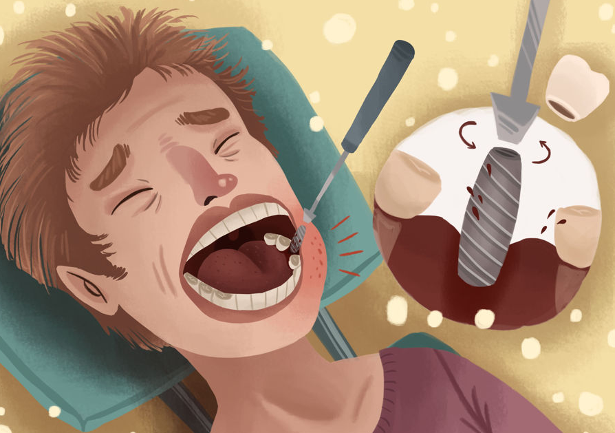 Factors and Signs of Dental Implant Failures